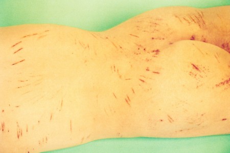 bushes_scratches bushes_scratches