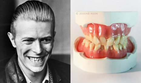 Artist Jessine Hein recreated David Bowie’s old teeth